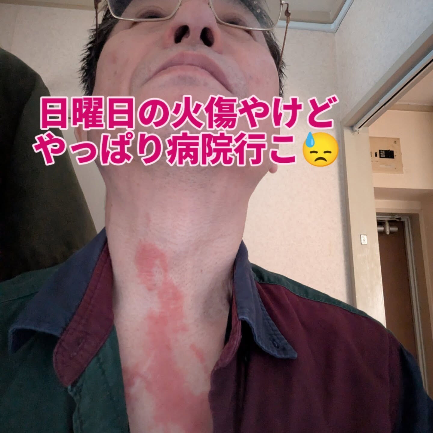 今日は店が休みなんで病院へ行って来よう😥　皮膚の弱いとこやか